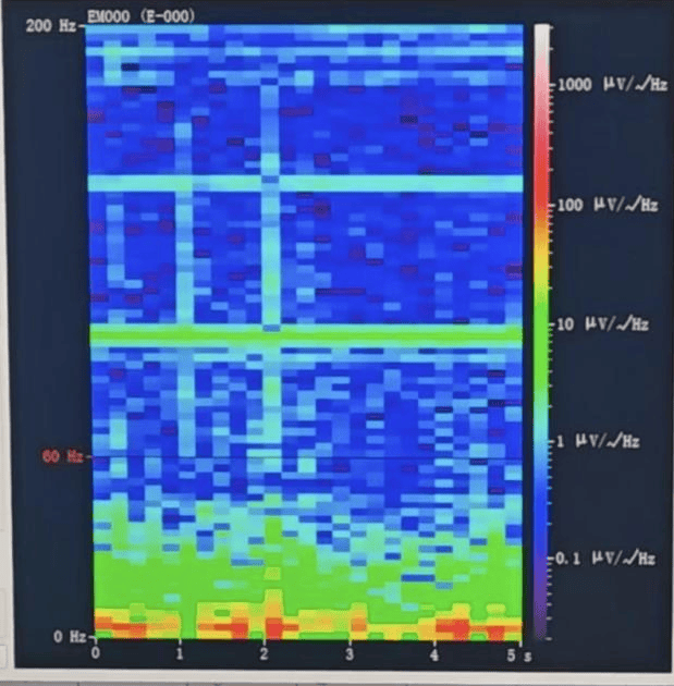 hga025怎么登录
_山西首例hga025怎么登录
！山西省人民医院成功实施脑机接口辅助功能区脑肿瘤切除手术