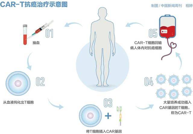 皇冠登3管理出租
_百万元的抗癌药皇冠登3管理出租
，有望大幅降价？