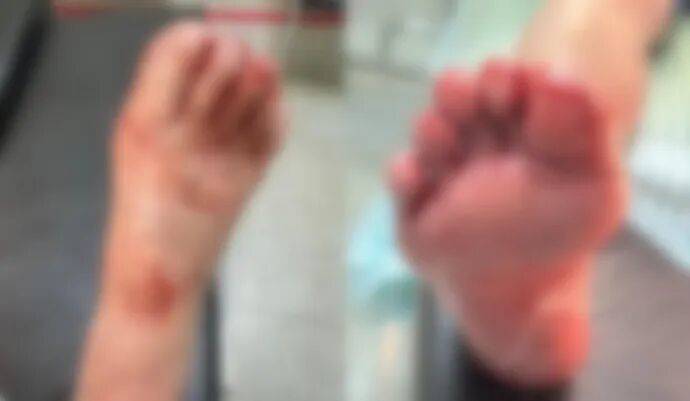 玻利维亚职业联赛
_洗澡时一声巨响玻利维亚职业联赛
,浙江小女孩腿上、脚上全是血!小心你家中藏的“不定时炸弹”……