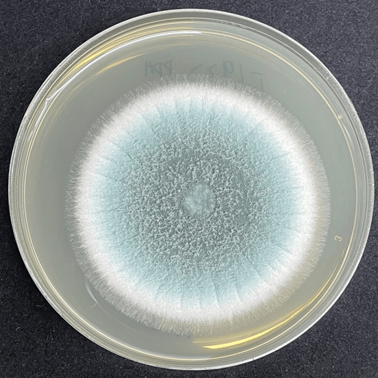 皇冠信用网代理注册_6岁女童发烧17天皇冠信用网代理注册，脑子竟被“啃”出十几个洞！“元凶”家中很常见！